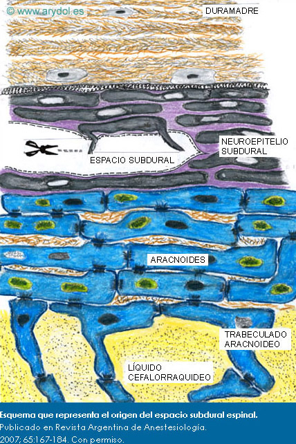 Esquema que representa el origen del espacio subdural espinal. Publicado en Revista Argentina de Anestesiología. 2007; 65:167-184. Con permiso.
