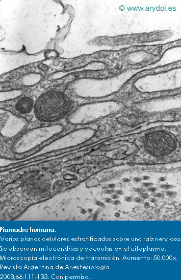 Piamadre humana. Varios planos celulares estratificados sobre una raíz nerviosa.Se observan mitocondrias y vacuolas en el citoplasma. Microscopía electrónica de transmisión. Aumento: 50.000x. Revista Argentina de Anestesiología. 2008;66:111-133. Con permiso.
